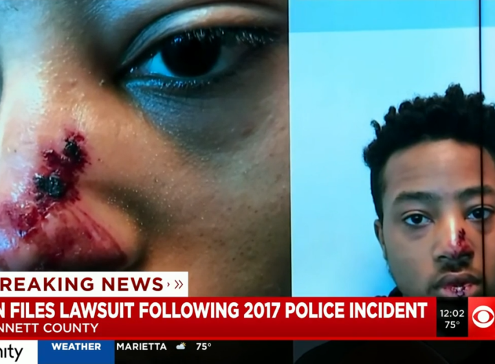 Man beaten by Gwinnett County police officers files lawsuit against county, attackers