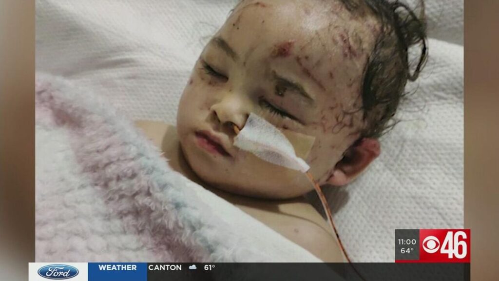 'The biggest thing is infection': Local toddler remains hospitalized weeks after dog attack