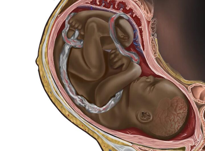 A viral image of a Black fetus is highlighting the need for diversity in medical illustrations