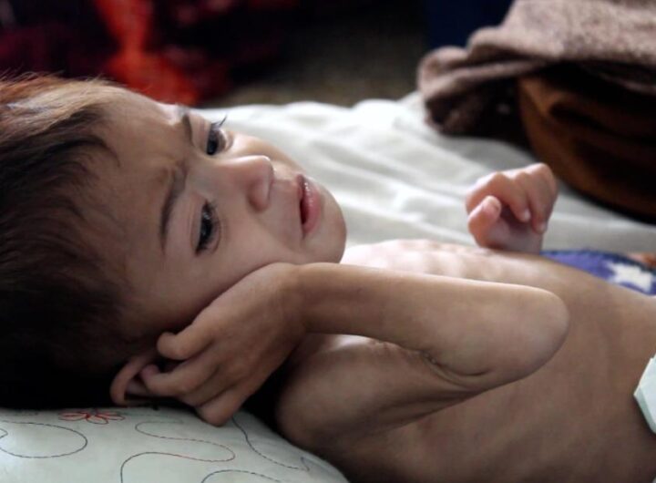 She's nearly 3 but as small as an infant. This is Afghanistan's hunger crisis